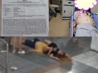 Rekaman CCTV dan foto kondisi korban serta laporan kasus dugaan pengeroyokan yang menimpa HR (Pria)  dan YS  (wanita) di lift KTV Majestik Tanjungpinang pada 28 Januari 2025, sekitar pukul 01.15 WIB lalu saat ini menjadi sorotan dan mengundang pertanyaan.  